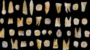 Caption-47-human-teeth-found-from-the-F