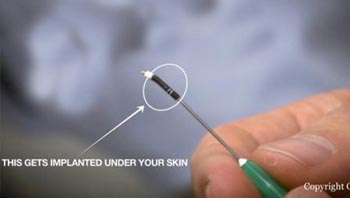 درمان فضانوردان با کپسول های زیستی ناسا