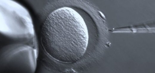 تولد یک نوزاد 3