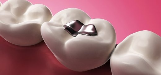 ترمیم خودکار دندان