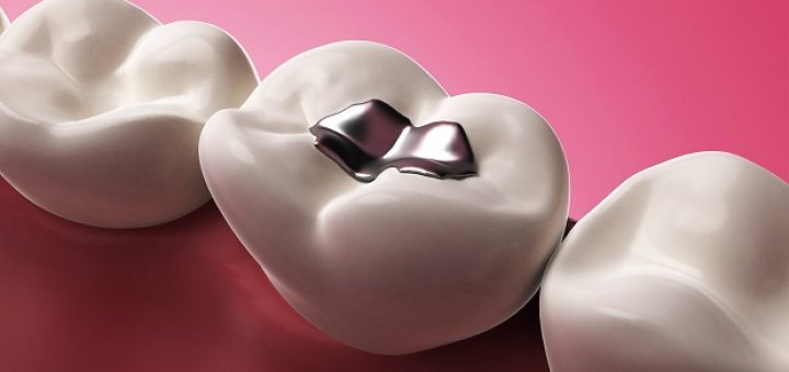 ترمیم خودکار دندان