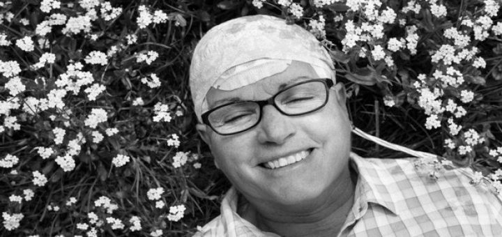 افزایش طول عمر بیماران تومور مغزی