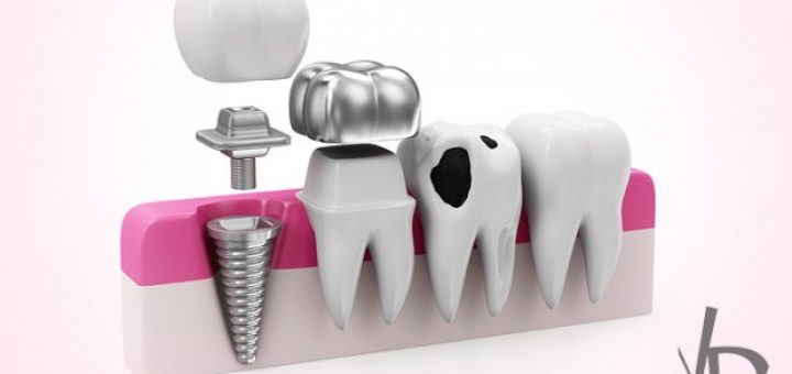 ترمیم خودکار دندان