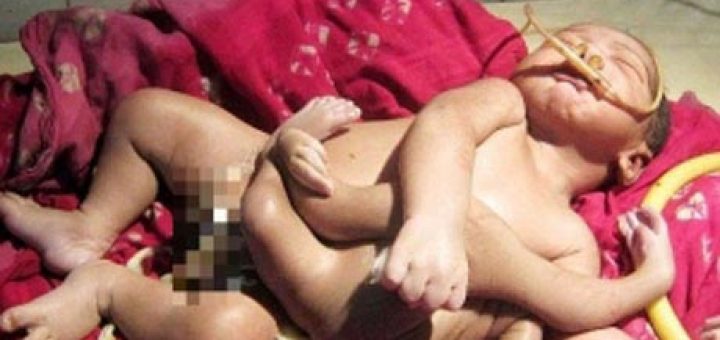 نوزاد هشت دست و پا