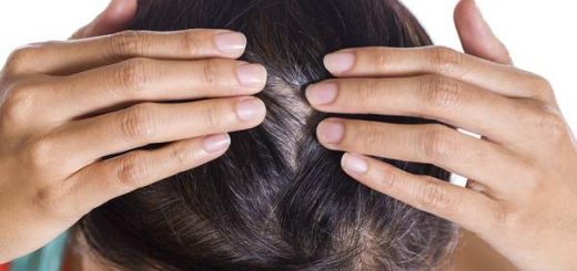 سریع سفید شدن مو