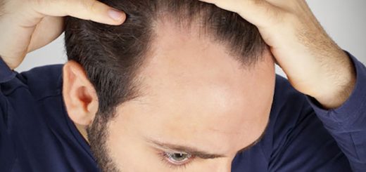 جلوگیری از ریزش مو در آقایان