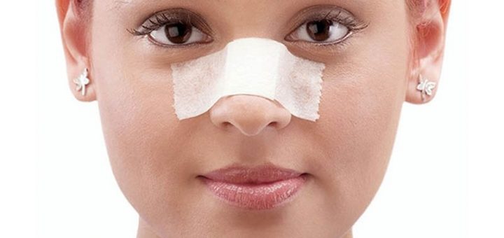 چسب زدن به بینی