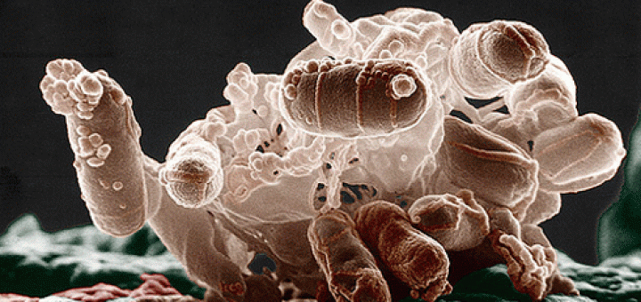 باکتری‌های اشریشیا کُلی زیر میکروسکوپ الکترونی