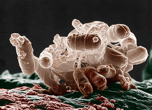 باکتری‌های اشریشیا کُلی زیر میکروسکوپ الکترونی