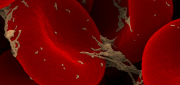 دانشمندان پیشنهاد می‌کنند که کلمه «سرطان» را فقط برای بیماری‌هایی به کار بریم که به احتمال زیاد منجر به مرگ می‌شوند. حتی مراحل اولیه بیماری هم نباید سرطان نامید شود.