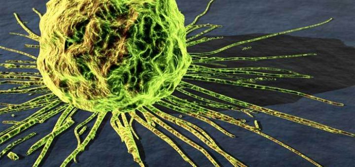 بيماری سرطان