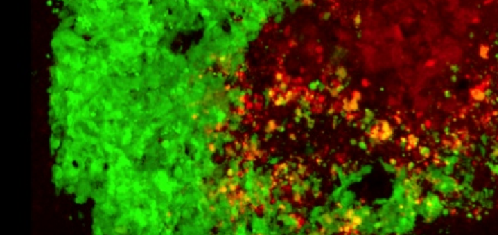سلول‌های بنیادی حامل ویروس هرپس به سلول‌های سرطانی حمله می‌کنند. سلول‌های تومور مغزی را به رنگ سبز می‌بینید و سلول‌های بنیادی حامل ویروس هرپس به رنگ قرمز. عکس: خالد شاه