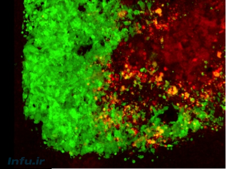 سلول‌های بنیادی حامل ویروس هرپس به سلول‌های سرطانی حمله می‌کنند. سلول‌های تومور مغزی را به رنگ سبز می‌بینید و سلول‌های بنیادی حامل ویروس هرپس به رنگ قرمز. عکس: خالد شاه