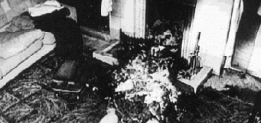 احتراق اعضای بدن