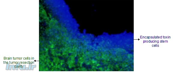 سلول‌های بنیادی حامل سموم سایتوتاکسین (آبی) در مجاورت سلول‌های سرطانی مغز (سبز)، سم تولید و ترشح می‌کنند. عکس: خالد شاه