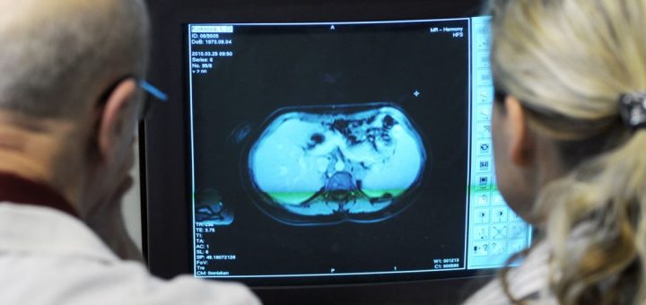 شیمی‌درمانی