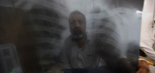 بیمار مبتلا به سل در پاکستان اکتبر سال ۲۰۱۶