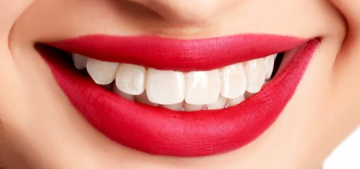 پیشگیری از پوسیدگی دندان