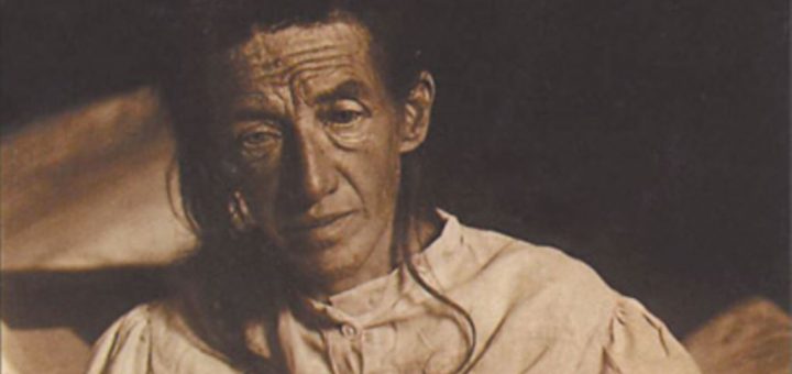 آگوسته دیتر نخستین کسی که آلویز آلزایمر بیماری «آلزایمر» او را تشخیص داد.