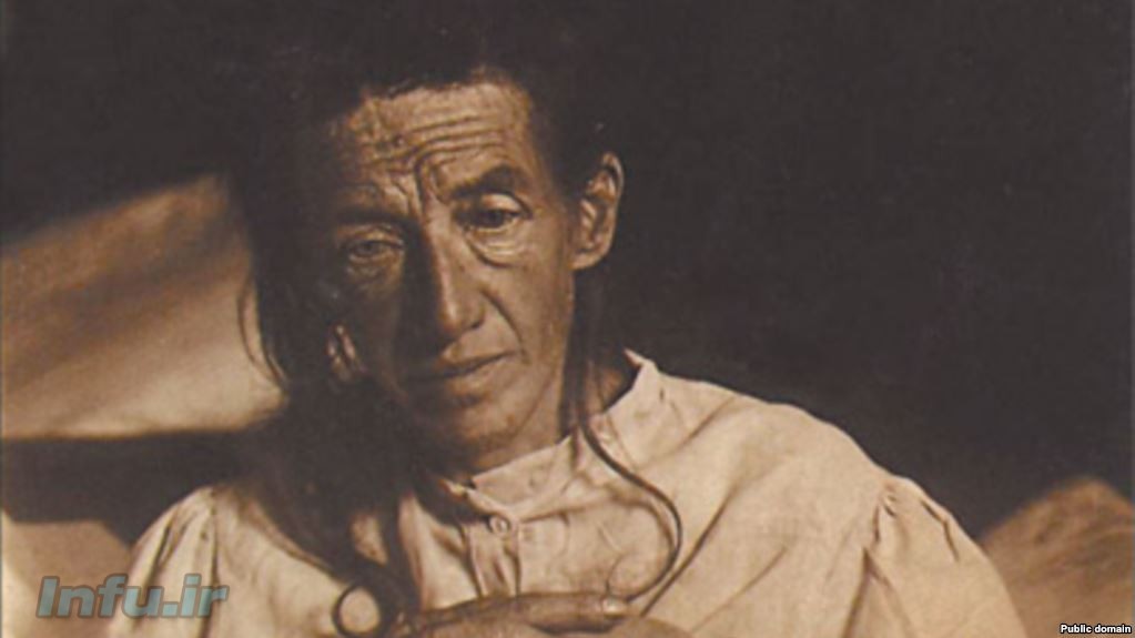 آگوسته دیتر نخستین کسی که آلویز آلزایمر بیماری «آلزایمر» او را تشخیص داد.