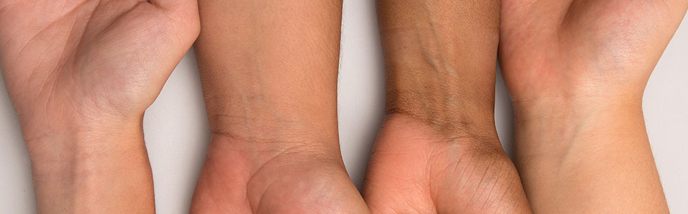 ته رنگ پوست