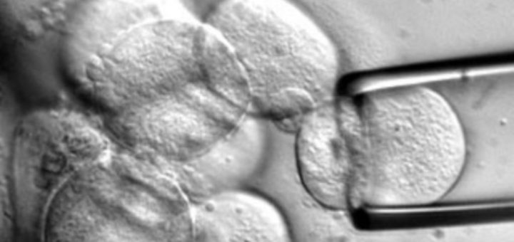 جنین خارج از رحم