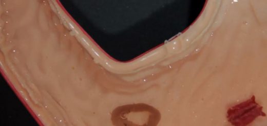 اعزام روبات