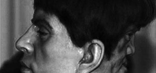 ادوارد مورداک