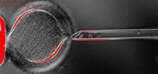 ویرایش ژنتیکی انسان