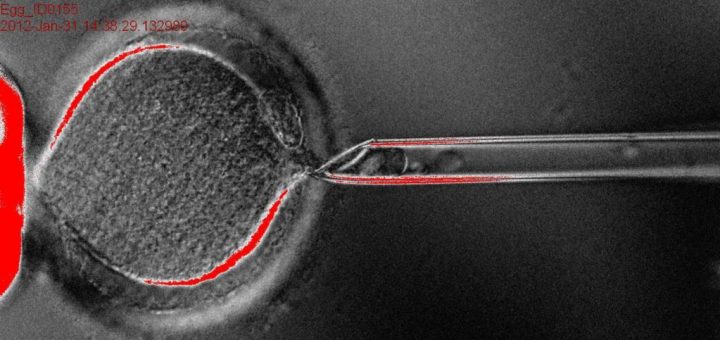 ویرایش ژنتیکی انسان