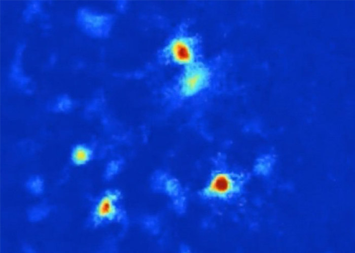 کنترل اضطراب در مغز با استفاده از نور