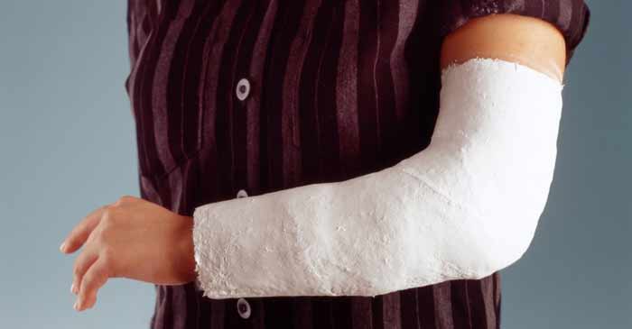 ایمپلنت‌ زیست مکانیکی برای بازسازی استخوان‌