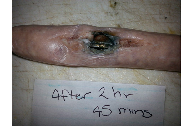 اثر باتری دکمه‌ای روی سوسیس پس از 2 ساعت !