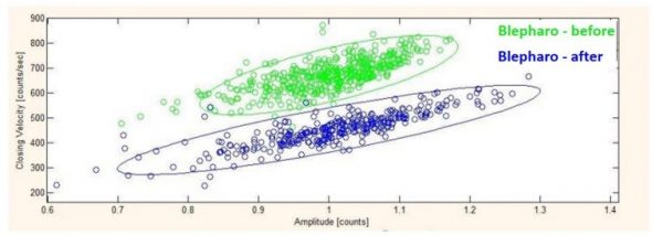 شناسایی بیماری با چشم