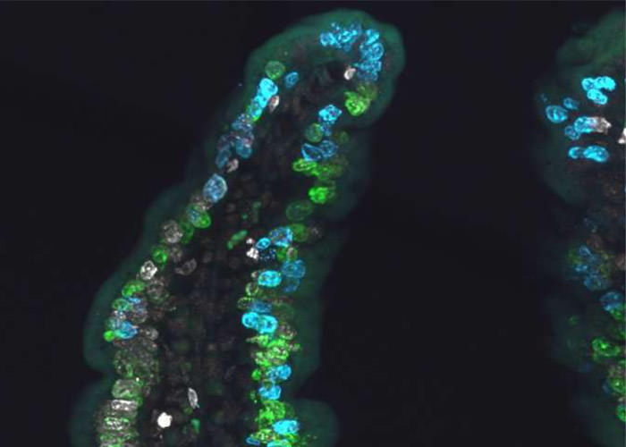 سلول‌های بنیادی روده