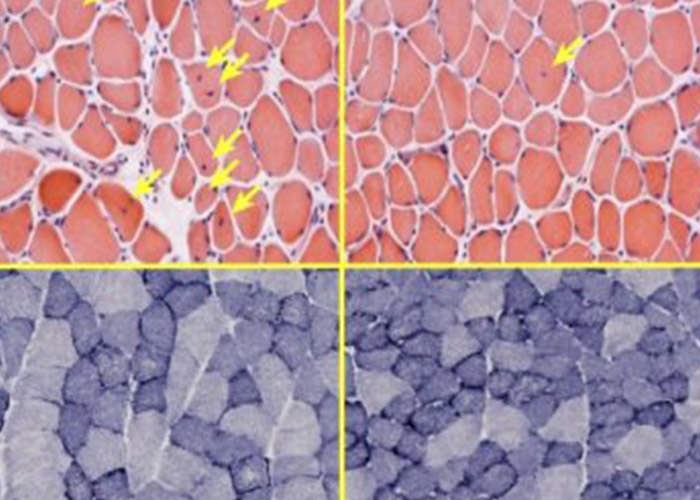 کلید قدرت ماهیچه ها-میتوکندری ها