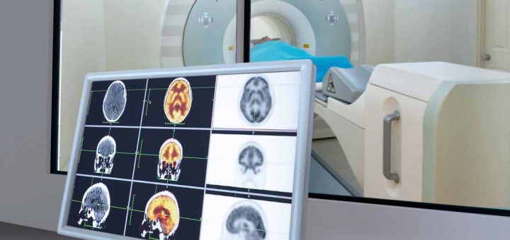 اسکن MRI از مغز