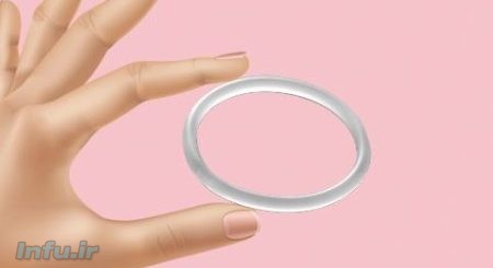 حلقه ضد بارداری